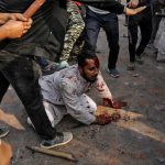 A year on, life is a struggle for Mohammed Zubair, who was beaten and left for dead during the violence at North East Delhi