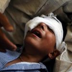 UN chief asks India to end use of pellet guns on Kashmir children