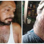 J&K: Brahmin Man Poisoned, Set on Fire Allegedly by Own Family for Refusing to Divorce Dalit Wife