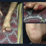 Kashmiri students attacked in Punjab as India loses cricket match to Pakistan