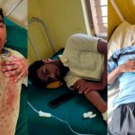 Karnataka: Muslim Student Abused, Beaten For ‘Wearing Skull Cap’ During Tuition, Then Threatened For Filing Complaint