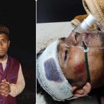 Muslim Youth, on Way to Mosque, Beaten Up in Jharkhand Village; Case Registered