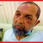 Hate Crime: After SC Intervention, Police Register Case Against 4 Unknown Assailants For Beating Muslim Man ( India Tomorrow )