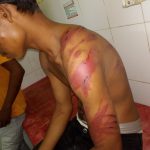 Uttar Pradesh: Dalit youth in Raebareli attacked over suspicion of theft, FIR registered (Maktoob)