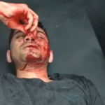 Muslim medical student brutally beaten with an iron rod by fellow students over Islamophobic movie